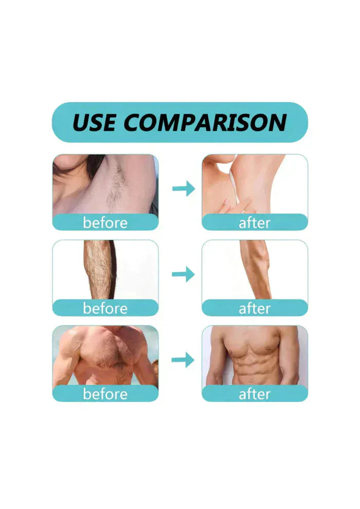 Ecrin Hair Removal Spray For Men & Women