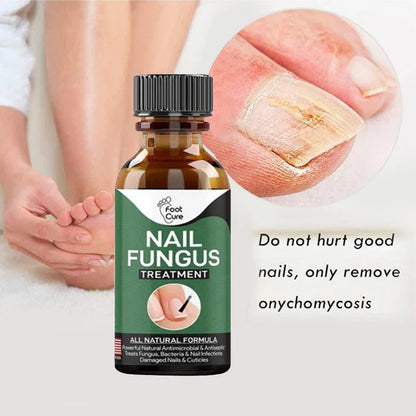 Fast Nail Fungal Treatments Nail Repair Essences Serum Care Treatments Foot Nail Fungus Removal Gel Paronychia Onychomycosis